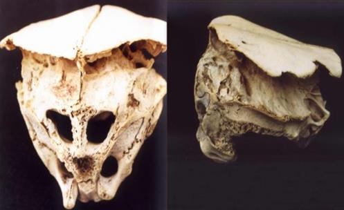 El cráneo de Rhodope