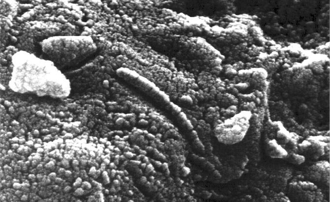 Microbacterias fosilizadas en el AH84001