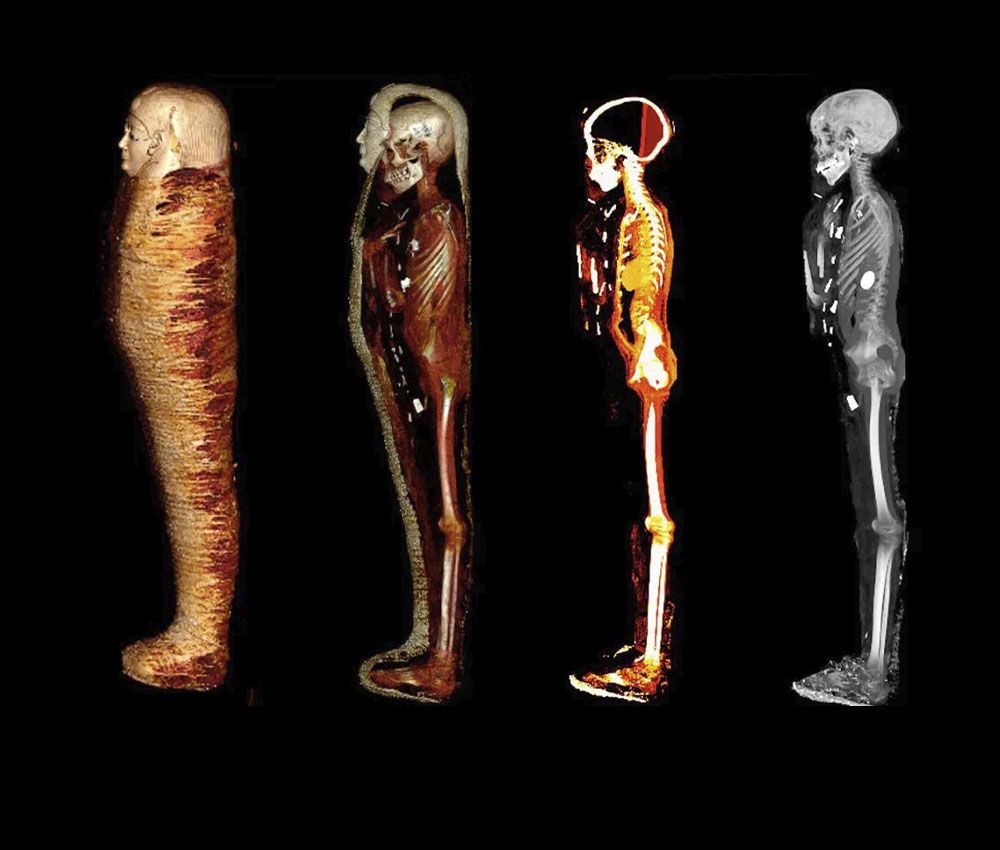 Distintos escáneres muestran el interior de la momia
