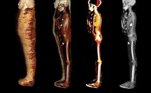 Distintos escáneres muestran el interior de la momia