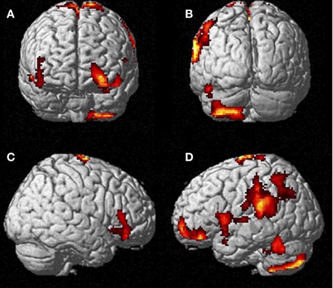 Regiones cerebrales activas cuando la participante experimentaba EFC