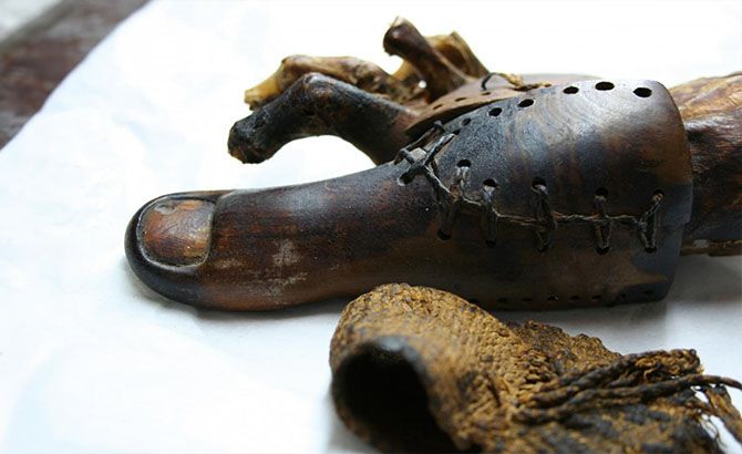 Dedo del pie de Greville Chester Dedo del pie de Greville Chester