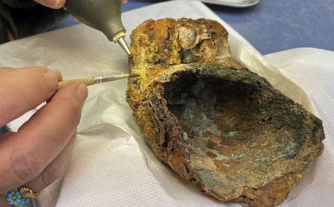 Una prótesis de cientos de años en estudio