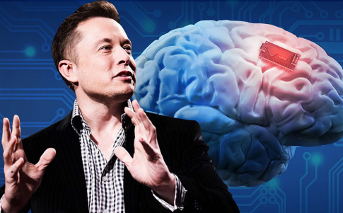 Elon Musk consigue implantar con éxito un dispositivo que lee el pensamiento