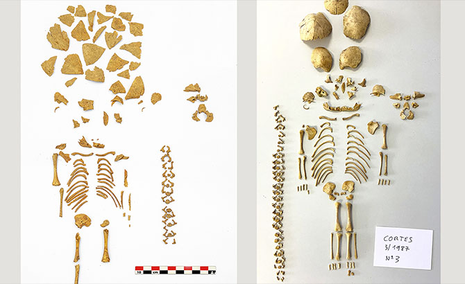 Los navarros de la Edad del Hierro ya cuidaban del síndrome de Down