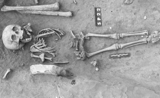 El niño con síndrome de Down desenterrado en Burdeos