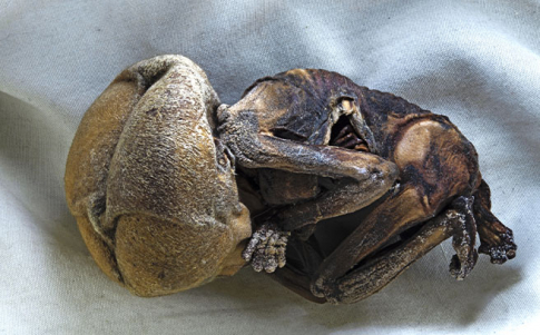 feto momificado feto momificado