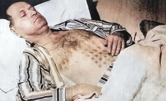 El soldador Stefan Michalak después de su encuentro 