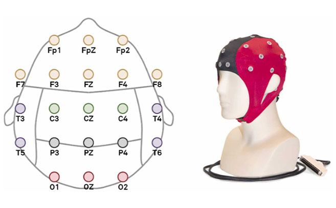 Configuración de los 21 canales organizados por regiones cerebrales
