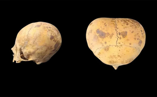 Dos imágenes del cráneo hallado en Argentina Dos imágenes del cráneo hallado en Argentina