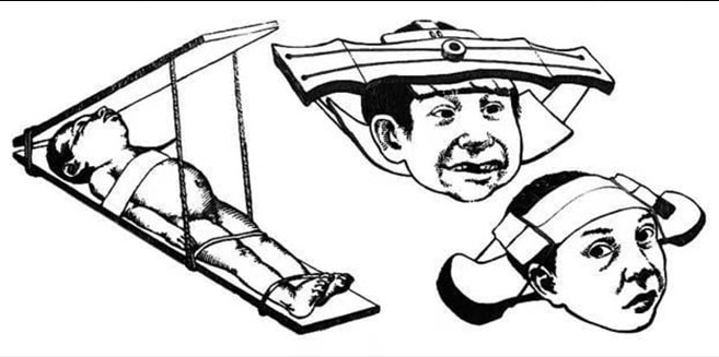 Tècnicas prehispánicas de deformación craneal Tècnicas prehispánicas de deformación craneal