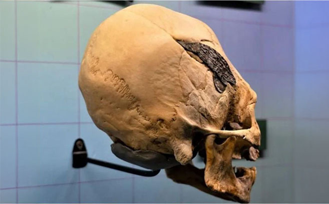 El cráneo visto desde la región occipital El cráneo visto desde la región occipital