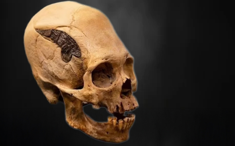 En Oklahoma se conserva este misterioso cráneo de dos mil años con un implante metálico