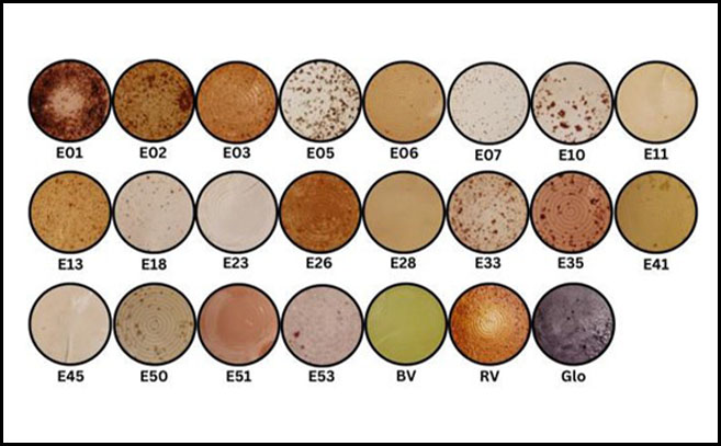 Filtros que muestran las bacterias púrpuras no sulfurosas medidas