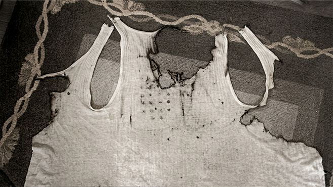 La camiseta de Michalak presentaba el mismo patrón en las quemaduras