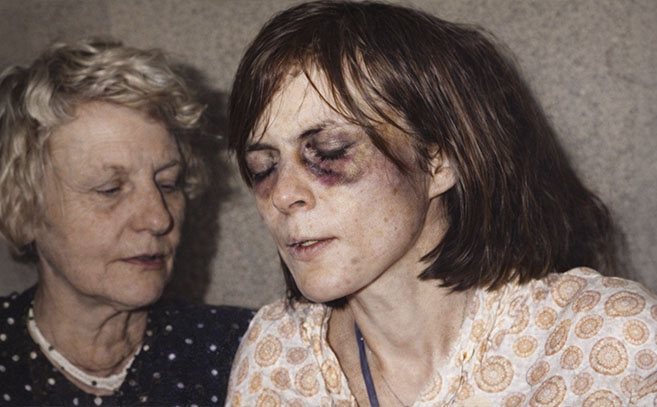 Las fotografías muestran como fue cambiando el rostro y el cuerpo de Annelise