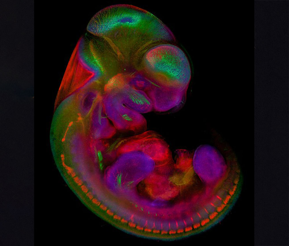Embrión de ratón de 10,5 días observado mediante microscopía de fluorescencia