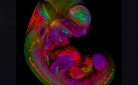 Embrión de ratón de 10,5 días observado mediante microscopía de fluorescencia