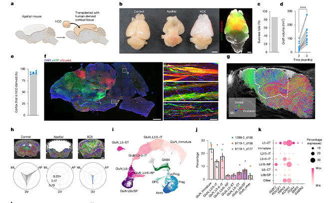 Trasplante de organoides corticales humanos en el ratón apalial Trasplante de organoides corticales humanos en el ratón apalial