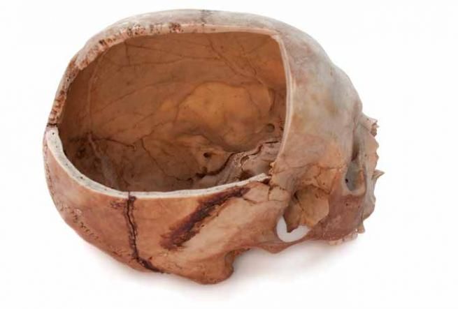 Trepanaciones rituales hace 6.000 años