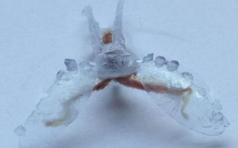 Los cyborgs ya están aquí...