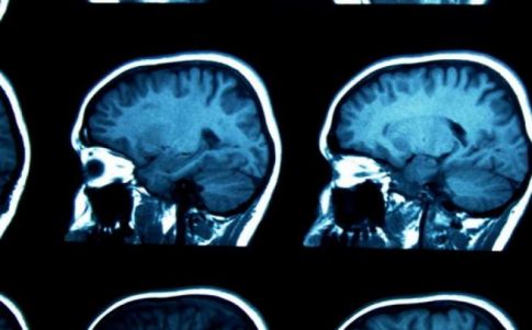 No es un lapsus... sino ahorro de energía.