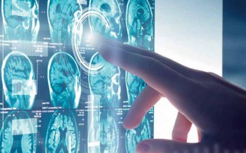 Un estudio revela qué estructuras profundas del cerebro deciden qué pensamientos llegan a la consciencia