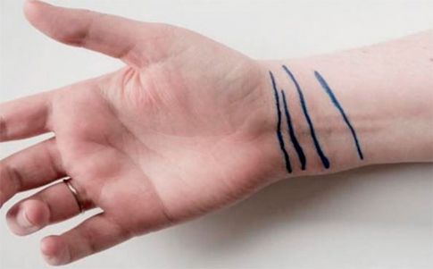 No todo el mundo tiene cuatro líneas en la muñeca